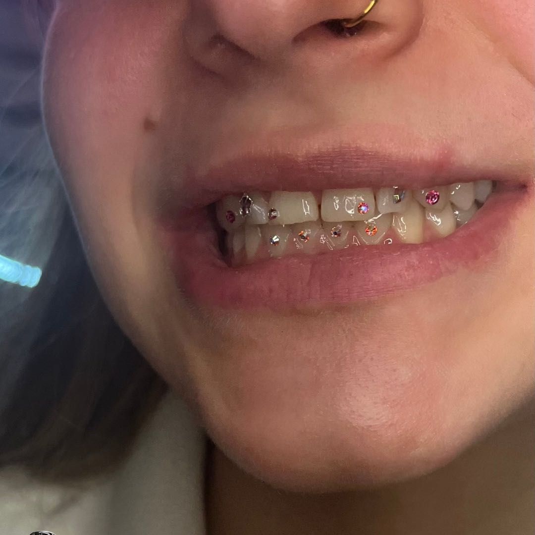 Tooth Gems – realizacja Beauty Time Dzierżoniów