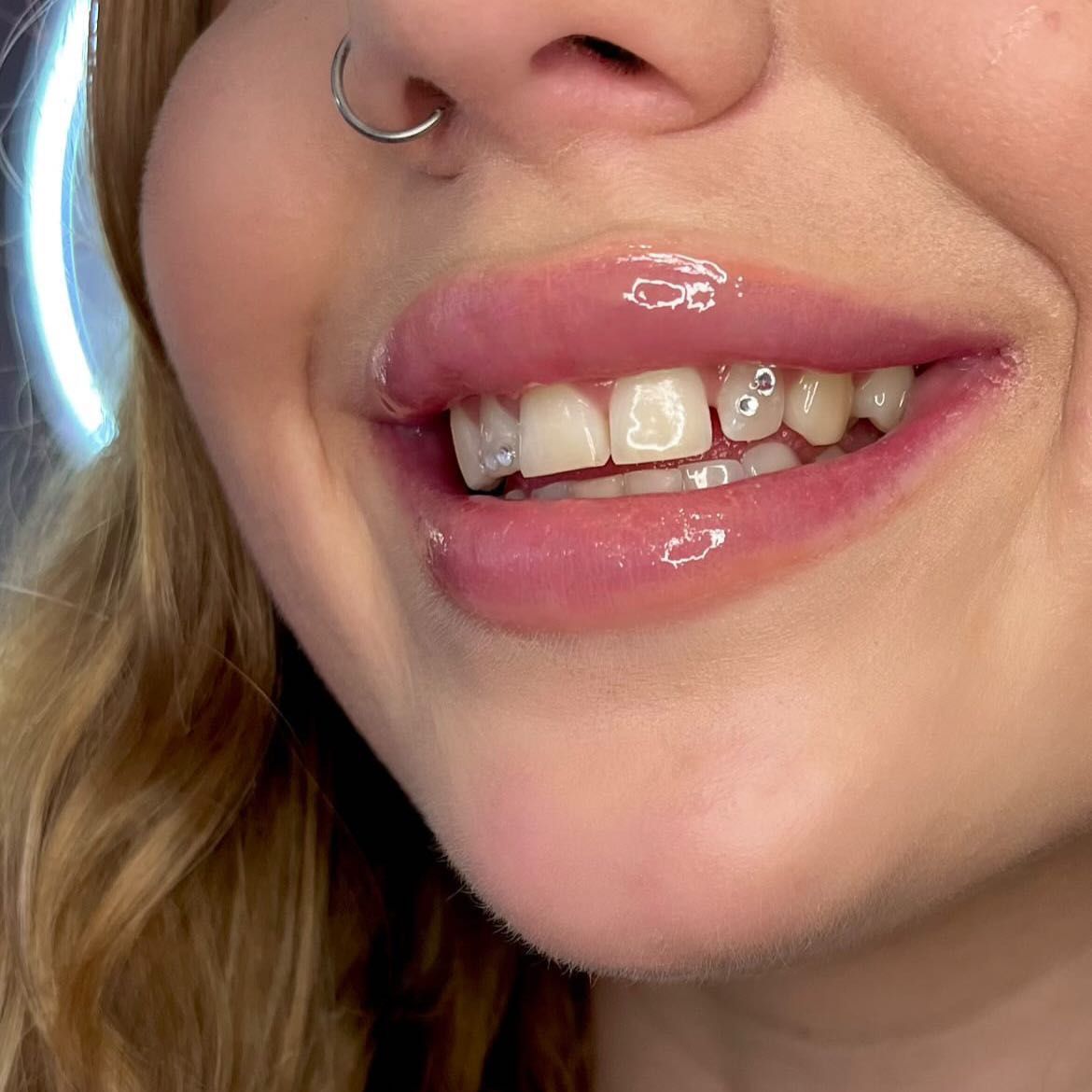 Tooth Gems – realizacja Beauty Time Dzierżoniów