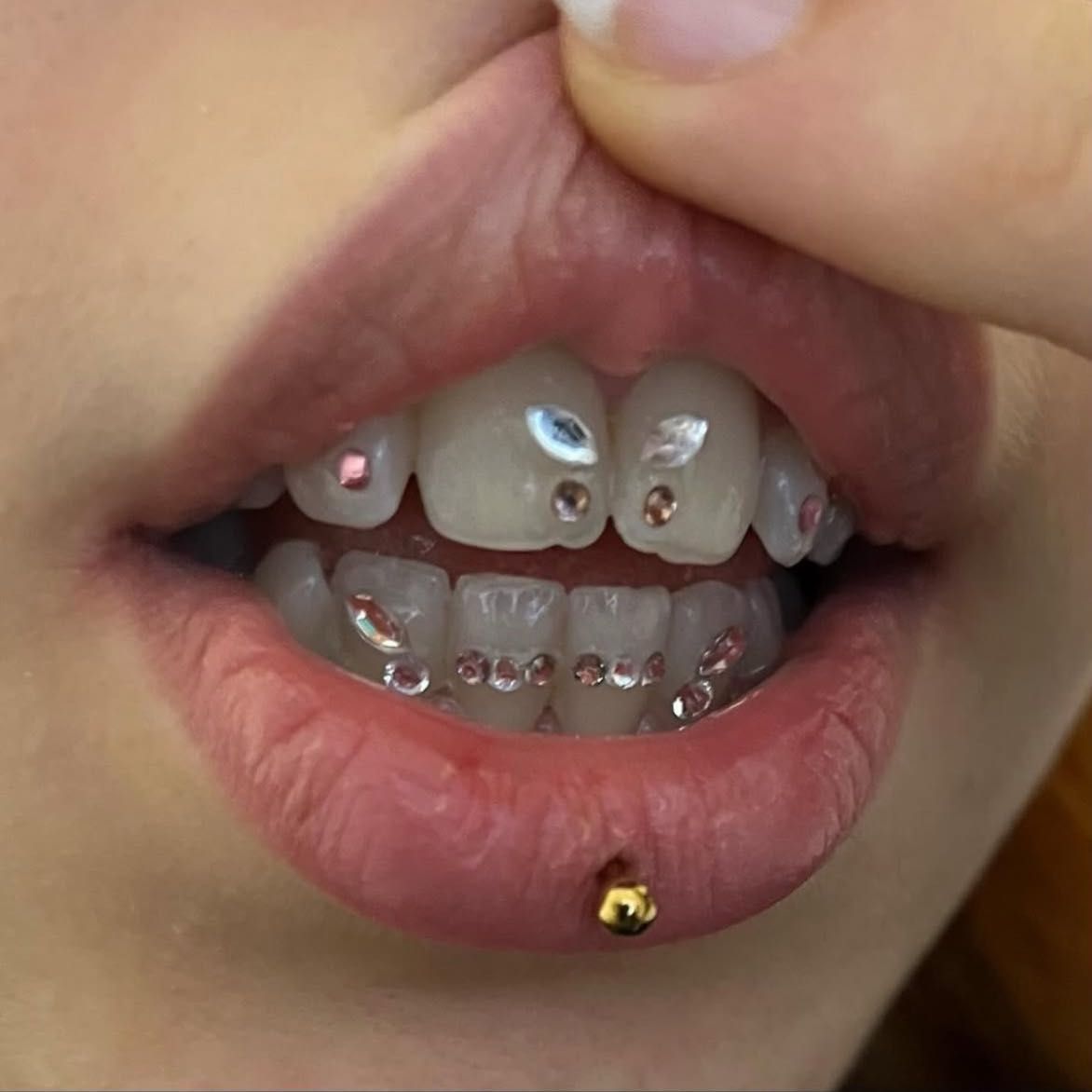 Tooth gems – kryształki na zęby